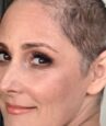 ricki lake hair loss battle