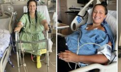 ‘It destroyed me’: Mum has to have leg amputated after tripping while playing with kids