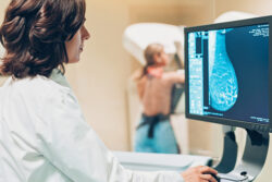 Breast cancer timebomb: Why we need to find the million women who have missed their mammograms
