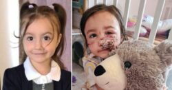 Girl, 5, left with life-changing injuries after neighbour’s dog ‘tore her face’