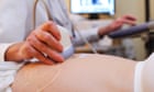 UK has second highest maternal death rate in eight-country European study