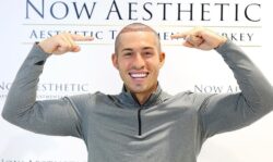 Love Island’s Connor Durman hopes to beat future baldness with hair transplant after shaving off his brown locks 