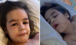 Strep A warning after infection left Nancie Rae, six, unable to walk and screaming in pain