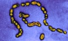 Fourth child dies in UK after contracting Strep A infection