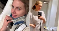 Actress Donna Air reveals she’s fractured her spine in two places just before Christmas