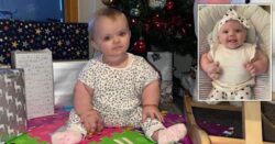 Baby’s arms double in size due to rare incurable condition