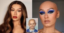 Influencer with alopecia who first lost her hair at 18-months-old wants to show that bald is beautiful