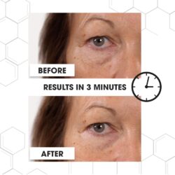 Wonder serum that gives you an eye lift in three minutes goes on sale – we got busy mums to see if it really works