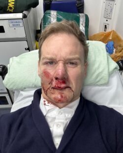 Dan Walker confirms TV return after horrific bike accident