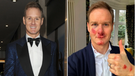 Dan Walker thanks make-up artist for ‘covering up the bruises’ as he returns to hosting for first time after horrific bike accident