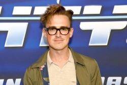 Tom Fletcher’s face miraculously appears in man’s stomach – but do you see it?