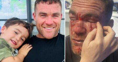 Fundraiser launched for dad ‘blinded’ in bottle attack hits £16,000